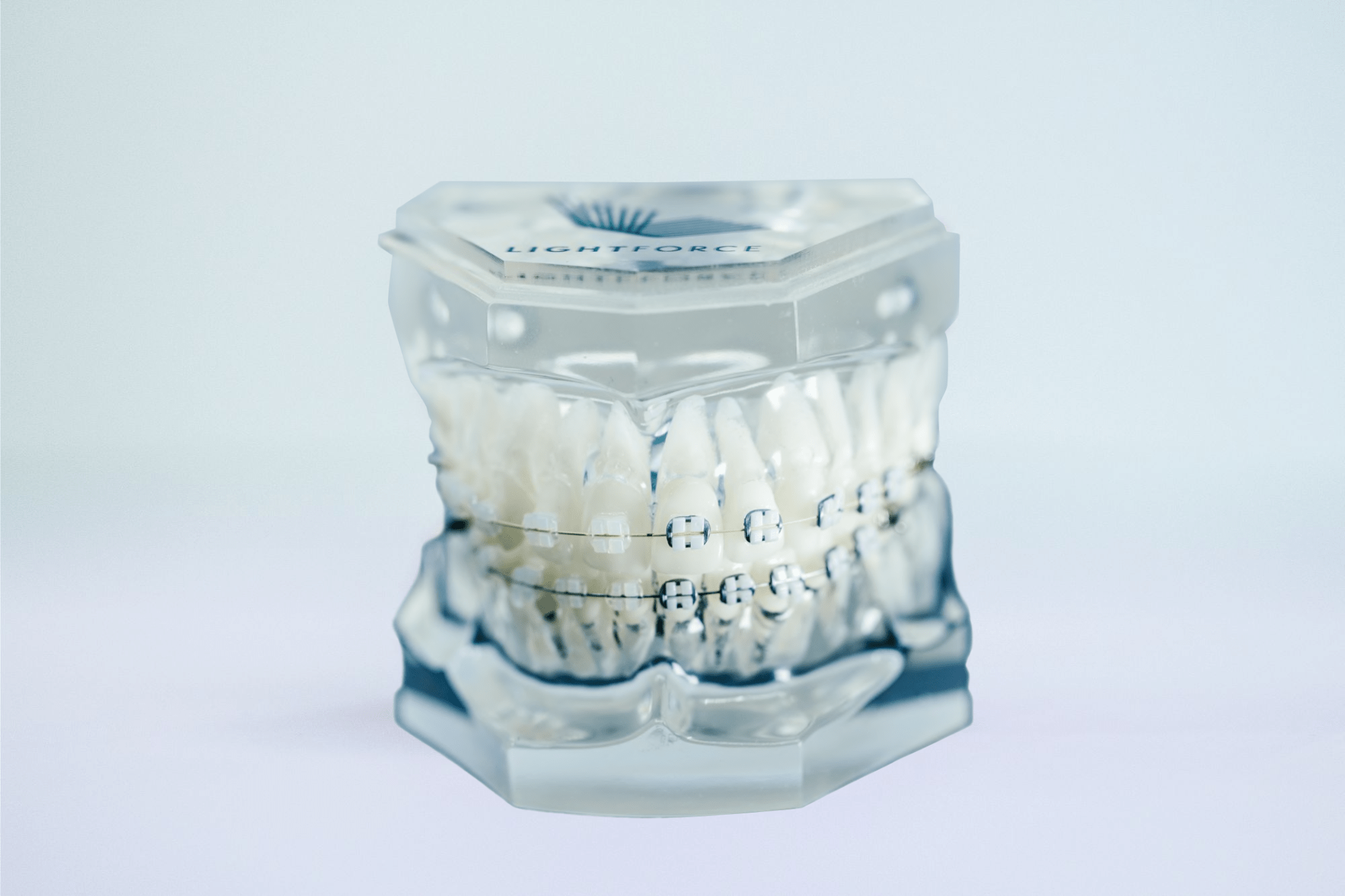 lightforce clear braces on plastic model